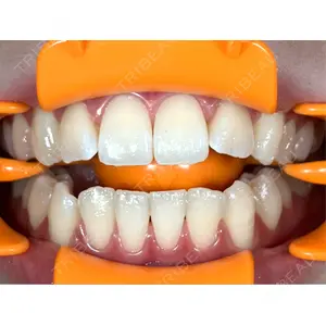 アンデルト歯科・矯正歯科口コミ