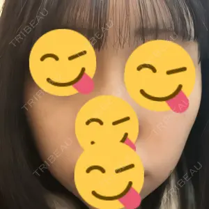 口コミ
