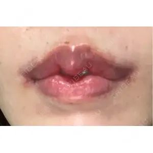 R Beauty CLINIC R Beauty CLINIC 銀座院口コミ
