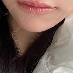 口コミ