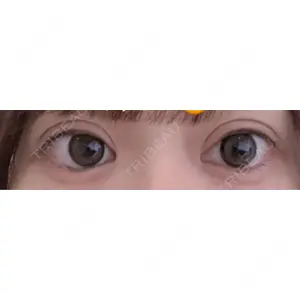 口コミ