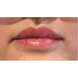 口コミ