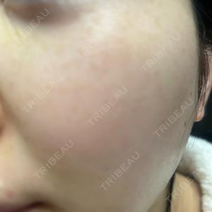 エルムクリニック 美容皮膚科エルムクリニック 福岡院口コミ