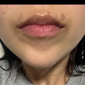 口コミ