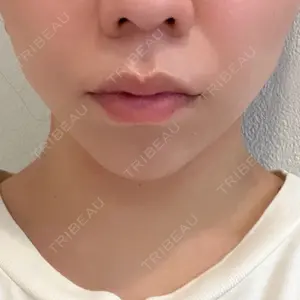 口コミ