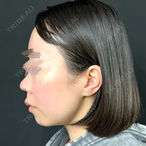 ルラ美容クリニック ルラ美容クリニック 新宿院口コミ