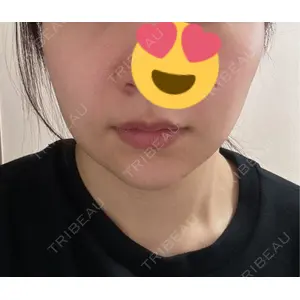 口コミ