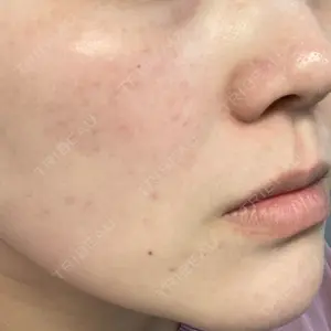 DAILY SKIN CLINIC DAILY SKIN CLINIC 心斎橋院口コミ