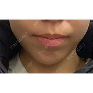 DMTC美容皮膚科 DMTC美容皮膚科 渋谷院口コミ