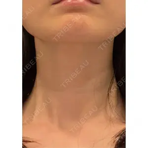 HELLATH CLINIC 新宿院口コミ