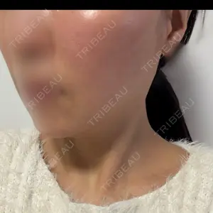 A CLINIC（エークリニック） A CLINIC（エークリニック） 銀座院口コミ