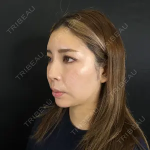 藤・ナチュレ美容クリニック 藤・ナチュレ美容クリニック 銀座院口コミ