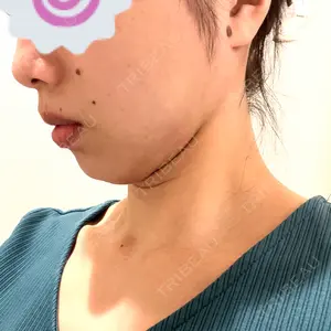 口コミ