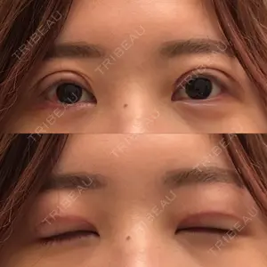 口コミ