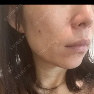 ルラ美容クリニック ルラ美容クリニック 札幌院口コミ