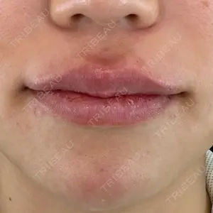 ルラ美容クリニック ルラ美容クリニック 大阪本院口コミ