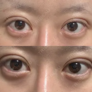 口コミ