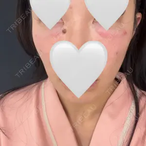 口コミ
