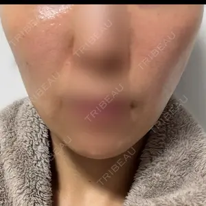 A CLINIC（エークリニック） A CLINIC（エークリニック） 銀座院口コミ