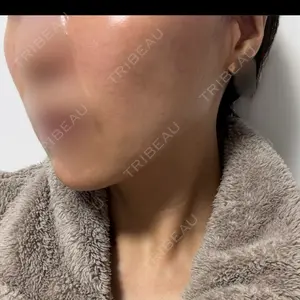 A CLINIC（エークリニック） A CLINIC（エークリニック） 銀座院口コミ