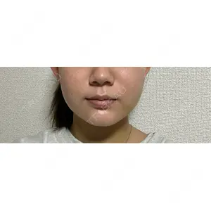 口コミ