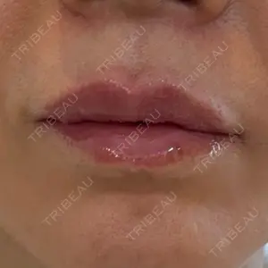 麻布十番クレールデンタルクリニック口コミ