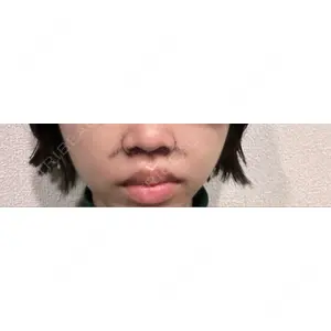 口コミ
