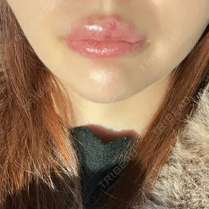 口コミ