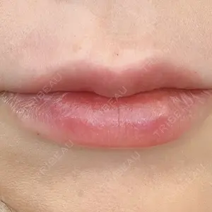 ルラ美容クリニック ルラ美容クリニック 大阪本院口コミ