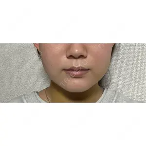 口コミ