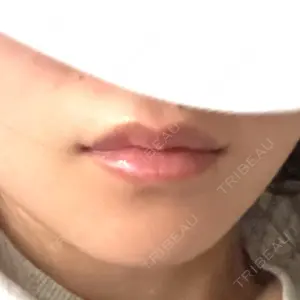 口コミ