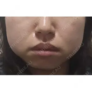 DMTC美容皮膚科 DMTC美容皮膚科 渋谷院口コミ
