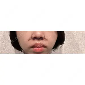 口コミ