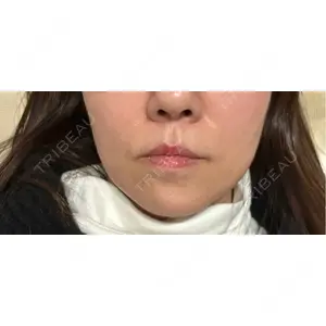 ゆきスキンクリニック 東池袋口コミ