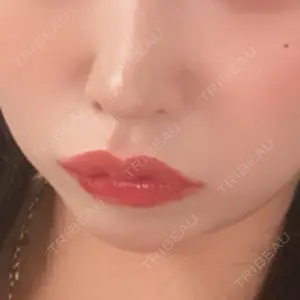 BiBiクリニック口コミ