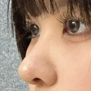 LUHO（ルホ）美容外科口コミ