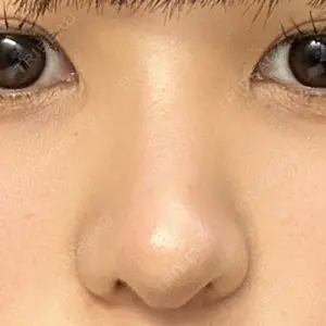 LUHO（ルホ）美容外科口コミ