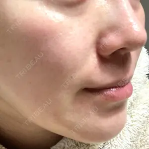 DAILY SKIN CLINIC DAILY SKIN CLINIC 心斎橋院口コミ