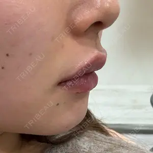 口コミ