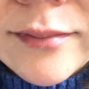 口コミ