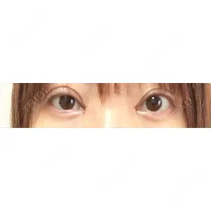 口コミ