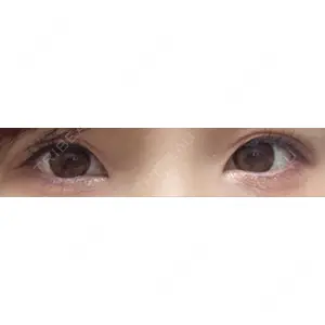 東京イセアクリニック口コミ