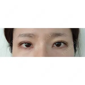 東京シンデレラ美容外科 東京シンデレラ美容外科 池袋院口コミ