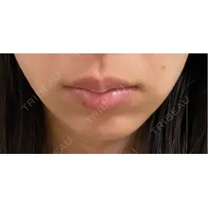 EMMO FACE CLINIC EMMO FACE CLINIC 大宮院口コミ