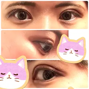 口コミ