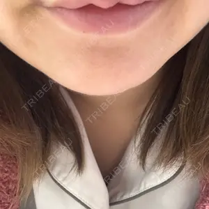 口コミ