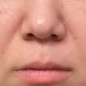 ミラクリニック ミラクリニック 池袋院口コミ