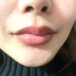 HAAB×DREAM BEAUTY CLINIC 大阪梅田院の