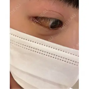 東京BELLEZZAクリニック口コミ