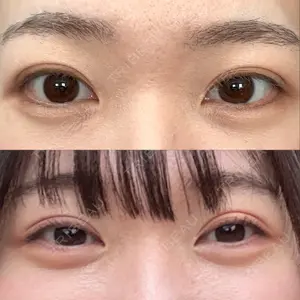 口コミ